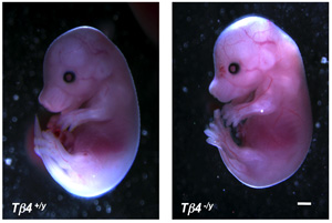 Thymosin beta 4 embryos